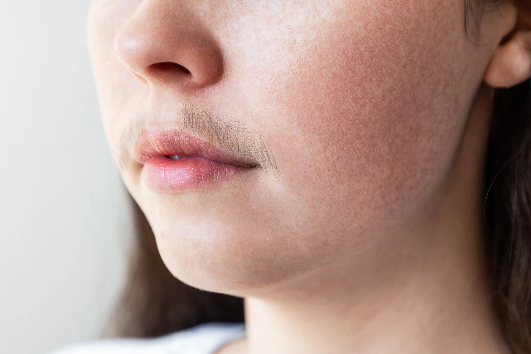 Facial Hair Treatment